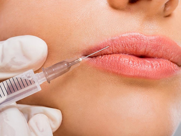 dermal fillers