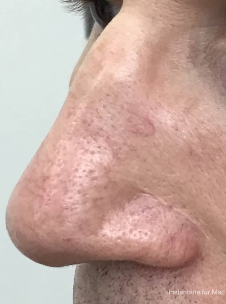 After Image