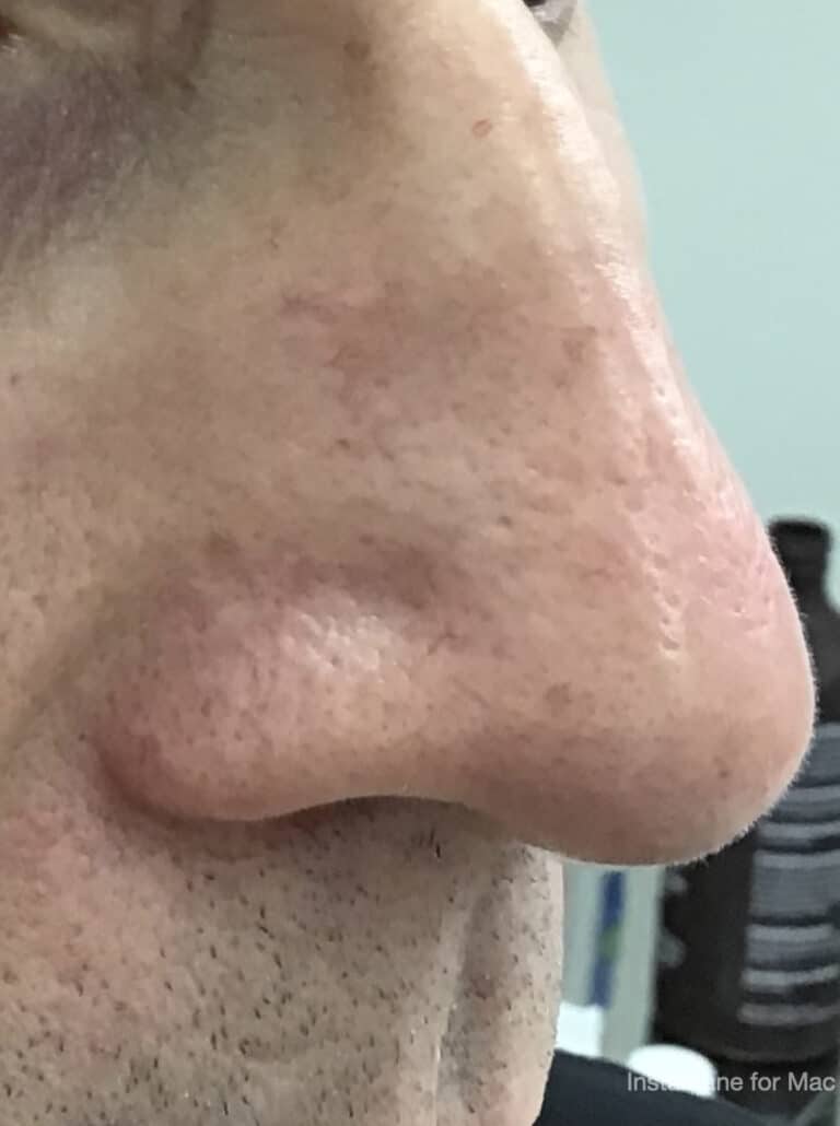 After Image