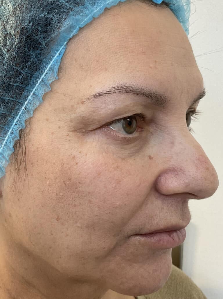 Before Image