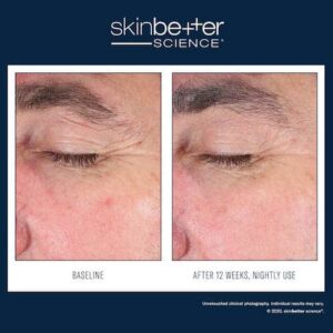 EyeMax AlphaRet Overnight Cream EN