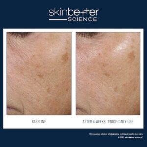 Trio Rebalancing Moisture Treatment EN