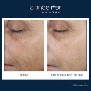 WFP 400304 W23 SKB BA 2000x2000 0008 Even Tone Correcting Serum EN