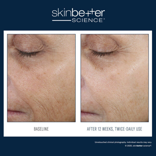 WFP 400304 W23 SKB BA 2000x2000 0008 Even Tone Correcting Serum EN
