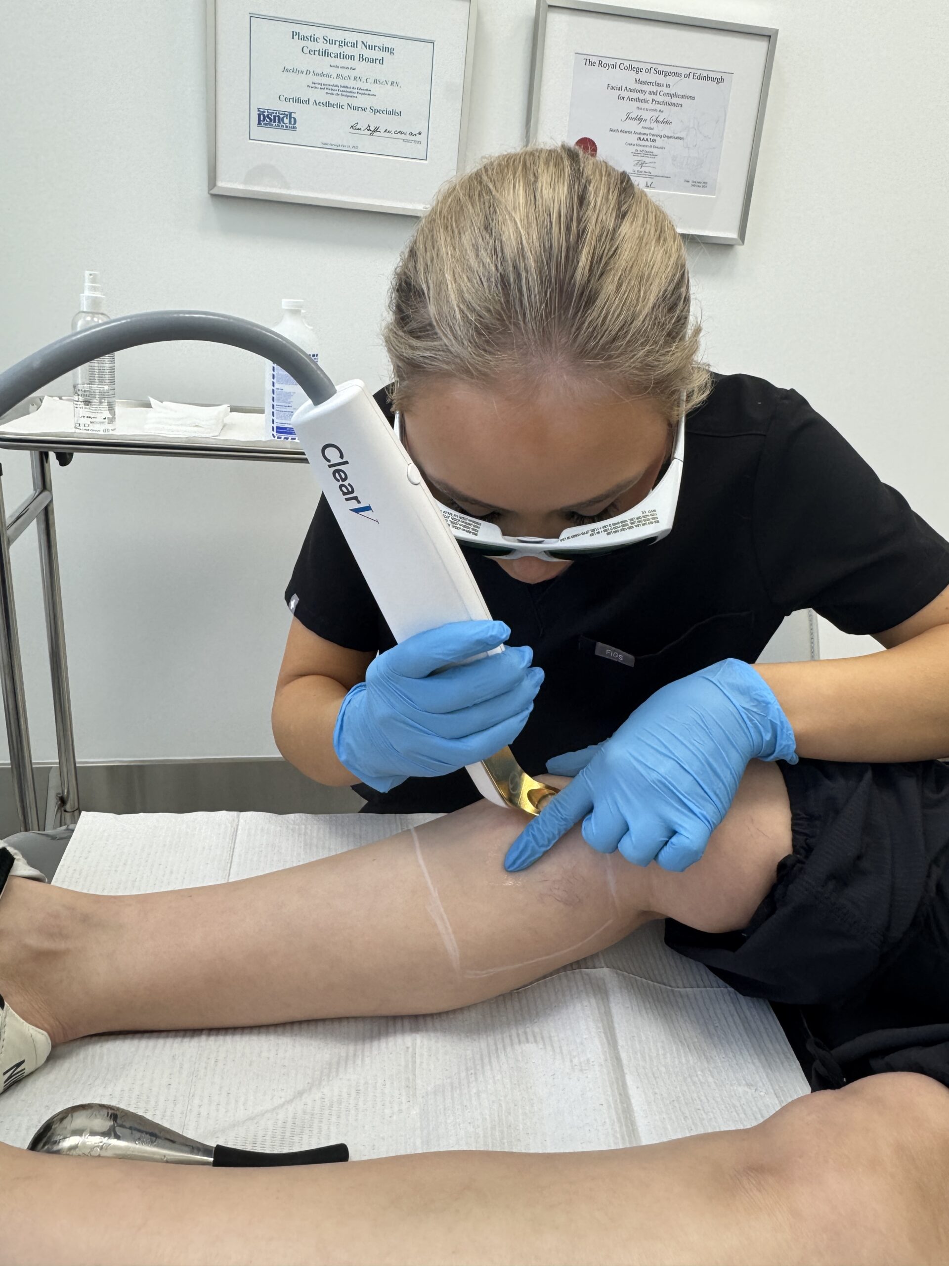 Provider performing a ClearV vascular laser treatment on a patient's lower leg at Distinct Medical Aesthetics in Oakville